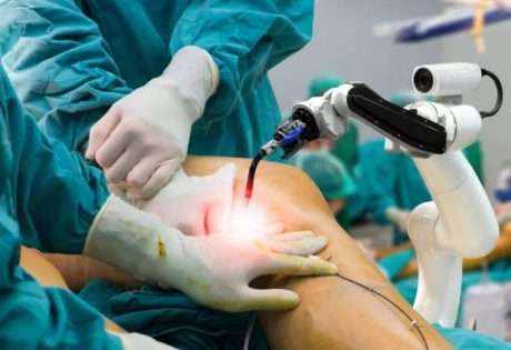 robotic knee replacement in chennai