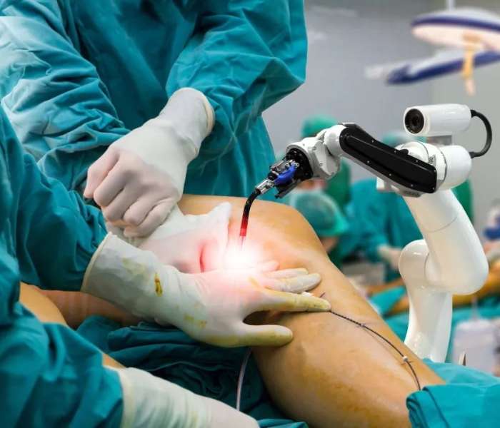 robotic knee replacement in chennai